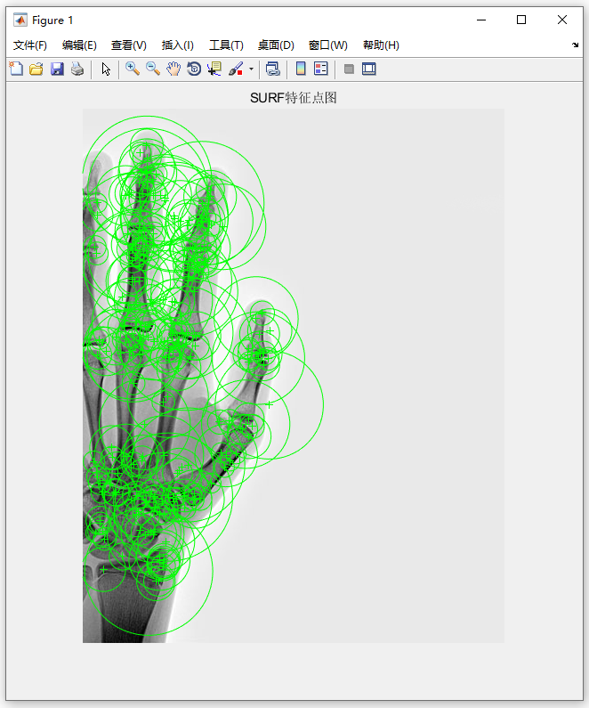 1.SURF特征点图.PNG