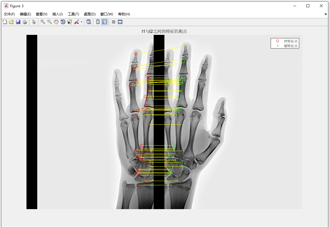 3.L1和L2之间的特征匹配点.PNG